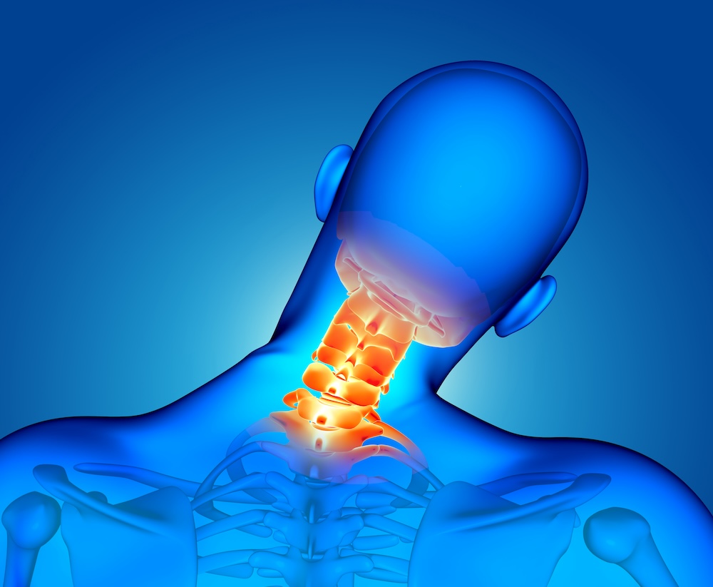 Best Cervical Spondylosis Treatment in Hyderabad