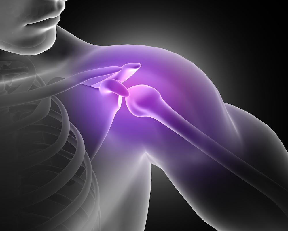 Best Frozen Shoulder Treatment in Hyderabad