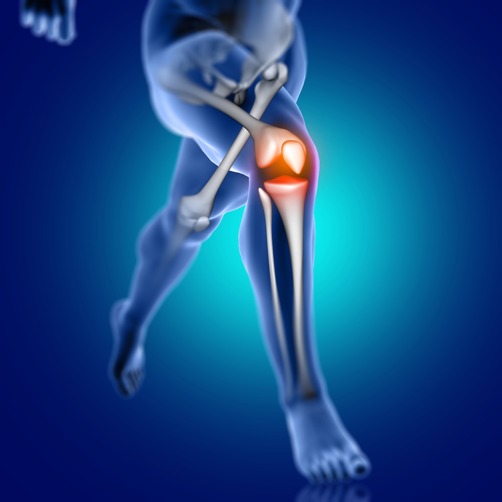 What Is an ACL Injury?